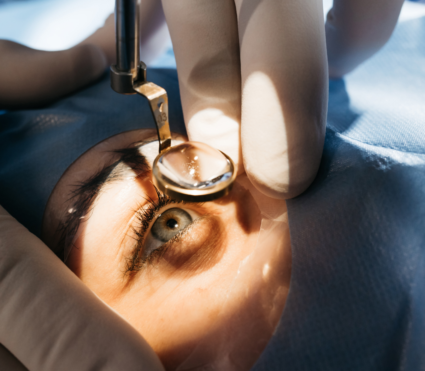 quel âge faire chirurgie réfractive | Dr Éric Prévot | Provins et Sens